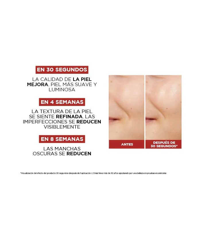 Loreal Paris - Revitalift Acide Glycolique Pur 5% Tonique Effet Peeling 3 Loreal Paris - Revitalift Acide Glycolique Pur 5% Tonique Effet Peeling – Image 3